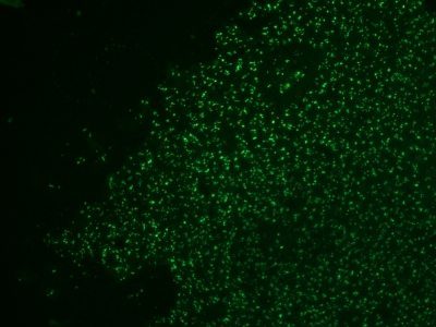 Monoclonal anti Nucleolin (364 5 + NCL/902)