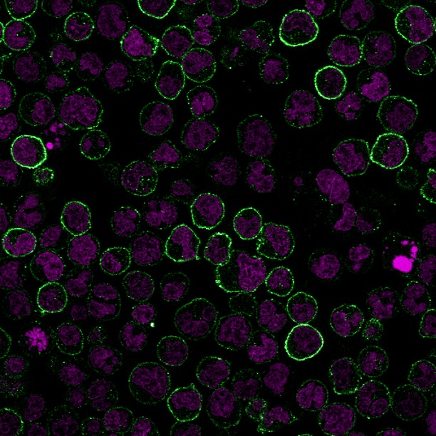CD19 Monoclonal Mouse Antibody (CVID3/155)