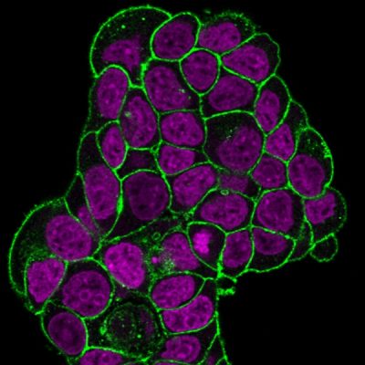 CD47 Monoclonal Mouse Antibody (IAP/964)