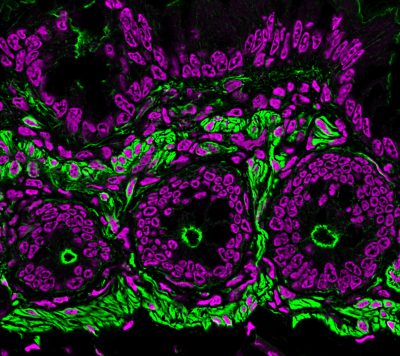 RedDot™2 Far-Red Nuclear Stain, 200X in DMSO - Image 4