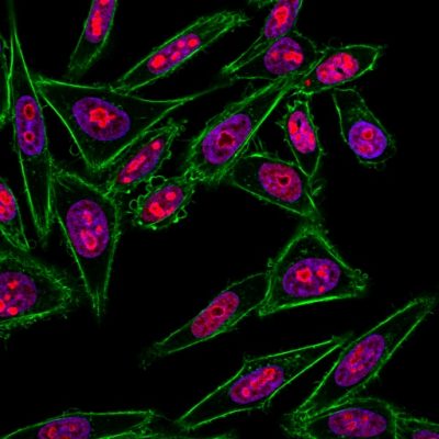 BNC550527 CF555 Nucleolin CF488A phalloidin