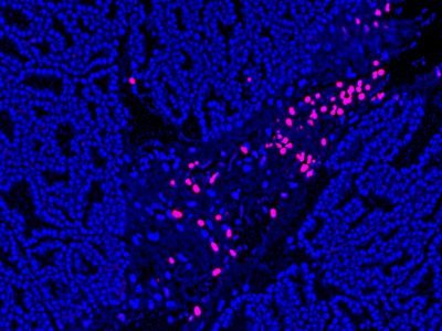 TUNEL Assay Apoptosis Detection Kit - Image 2