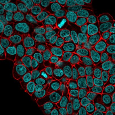 Ep-CAM / CD326 Monoclonal Mouse Antibody (VU-1D9)