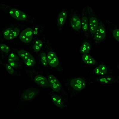 Nucleolin Monoclonal Mouse Antibody (NCL/902)