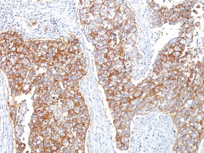 Ep-CAM / CD326 Monoclonal Mouse Antibody (HEA125) - Image 2