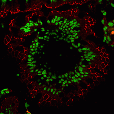 CF555 Mix-n-Stain NucSpot 470 TrueBlack Background Suppressing System Background Suppressor intestine