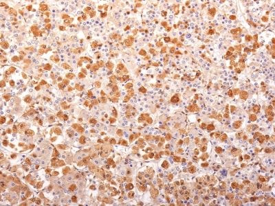 ACTH Recombinant Monoclonal Mouse Antibody (r57)