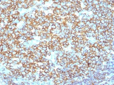 CD20 Recombinant Monoclonal Rabbit Antibody (IGEL/1497R)