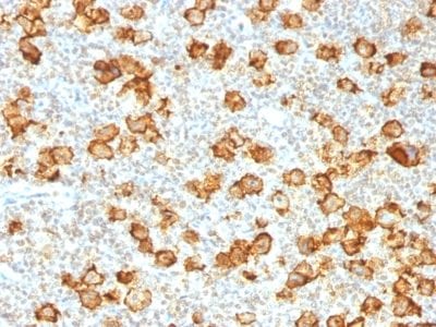 CD30 / TNFRSF8 Recombinant Monoclonal Rabbit Antibody (Ki-1/1505R)