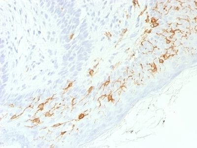 CD1a Recombinant Monoclonal Rabbit Antibody (C1A/1506R)