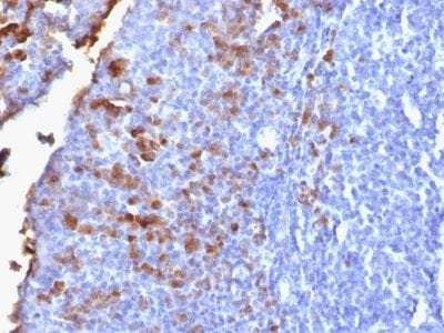 Human IgG Recombinant Monoclonal Rabbit Antibody (IG1707R)