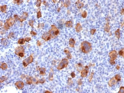 CD30 / TNFRSF8 Recombinant Monoclonal Rabbit Antibody (Ki-1/1747R)