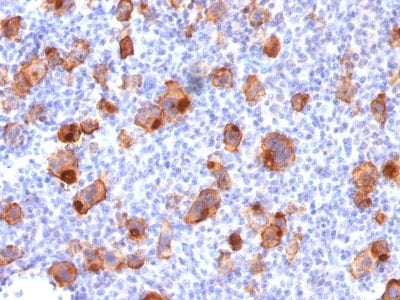 CD30 / TNFRSF8 Recombinant Monoclonal Mouse Antibody (rKi-1/779)
