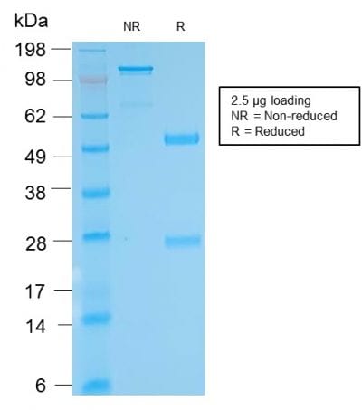 SDS-PAGE Analysis Purified anti-biotin Rabbit Recombinant Monoclonal antibody (BTN/2032R). Confirmation of Purity and Integrity of Antibody.