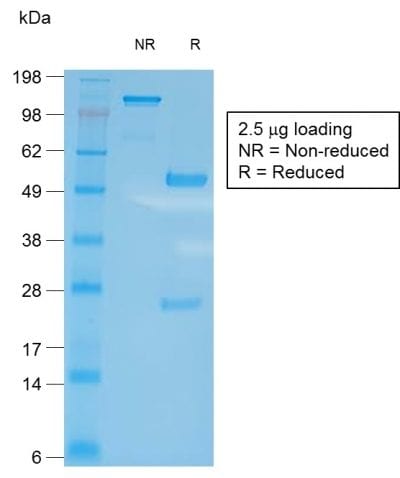 SDS-PAGE Analysis of Purified CD27 Rabbit Recombinant Monoclonal Antibody (LPFS2/2034R). Confirmation of Purity and Integrity of Antibody.