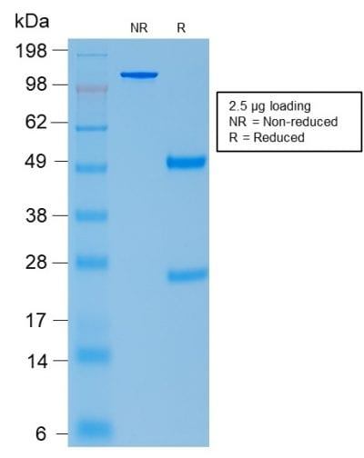 SDS-PAGE Analysis Purified ACTH Rabbit Recombinant Monoclonal Antibody (CLIP/2040R). Confirmation of Purity and Integrity of Antibody.