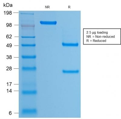 SDS-PAGE Analysis Purified HPV-16 Mouse Recombinant Monoclonal Antibody (rHPV16L1/1058). Confirmation of Purity and Integrity of Antibody.