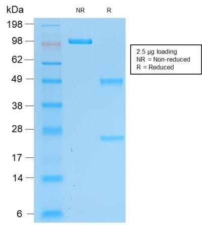 SDS-PAGE Analysis Purified Pgp9.5 Mouse Recombinant Monoclonal Antibody (rUCHL1/775). Confirmation of Purity and Integrity of Antibody.