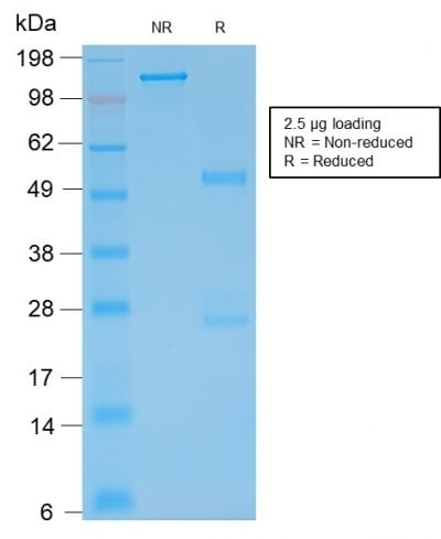 SDS-PAGE Analysis Purified GFAP Mouse Recombinant Monoclonal Antibody (rASTRO/789). Confirmation of Purity and Integrity of Antibody.