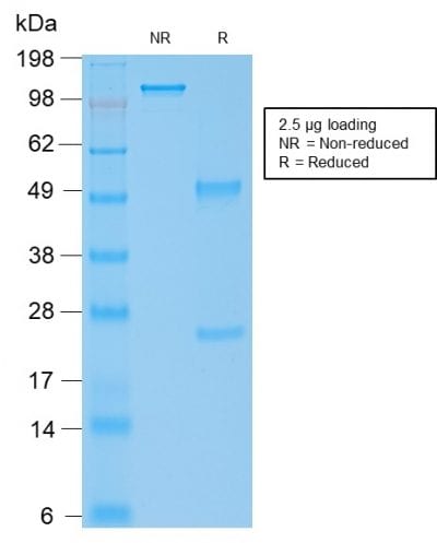 SDS-PAGE Analysis Purified IgG4 Mouse Recombinant Monoclonal Antibody (rIGHG4/1345). Confirmation of Purity and Integrity of Antibody.