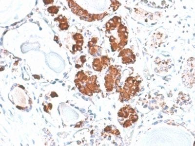 Formalin-fixed paraffin-embedded human Pituitary stained with ACTH Mouse Recombinant Monoclonal Antibody (rCLIP/1407).