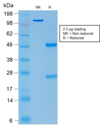 SDS-PAGE Analysis Purified ACTH Mouse Recombinant Monoclonal Antibody (rCLIP/1407). Confirmation of Purity and Integrity of Antibody.