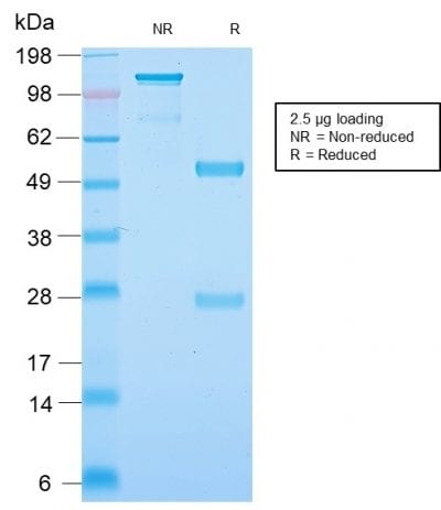 SDS-PAGE Analysis of Purified Neurofilament Rabbit Recombinant Monoclonal Antibody (NEFL.H/2324R). Confirmation of Purity and Integrity of Antibody.