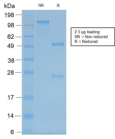 SDS-PAGE Analysis Purified Neurofilament Mouse Recombinant Monoclonal Antibody (rNF421). Confirmation of Purity and Integrity of Antibody.