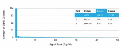 Z- and S- Score: Akt1 Mouse Monoclonal Antibody (AKT1/2552).