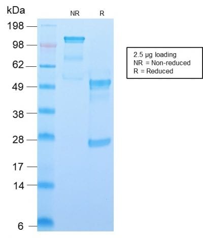 SDS-PAGE Analysis Purified CD34 Recombinant Rabbit Monoclonal Antibody (HPCA1/2598R). Confirmation of Purity and Integrity of Antibody.