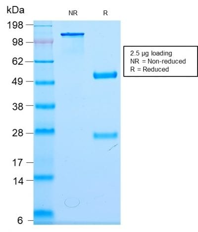 SDS-PAGE Analysis Purified Neurofilament Rabbit Monoclonal Antibody (NEFL/2983R). Confirmation of Purity and Integrity of Antibody.