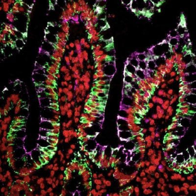 Tyramide Amplification Kit with HRP Streptavidin and CF® Dye or Biotin Tyramide