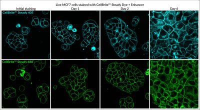 CellBrite® Steady Membrane Staining Kits - Image 5