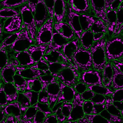 CellBrite® Steady Membrane Staining Kits - Image 7