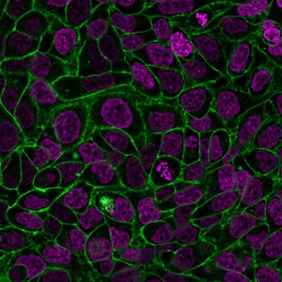 CellBrite® Steady Membrane Staining Kits - Image 2