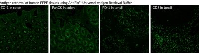 AntiFix™ Universal Antigen Retrieval Buffer, 10X - Image 2