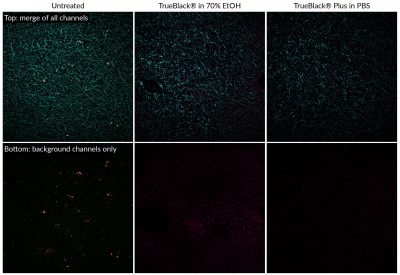 TrueBlack® Plus Lipofuscin Autofluorescence Quencher, 40X in DMSO - Image 3