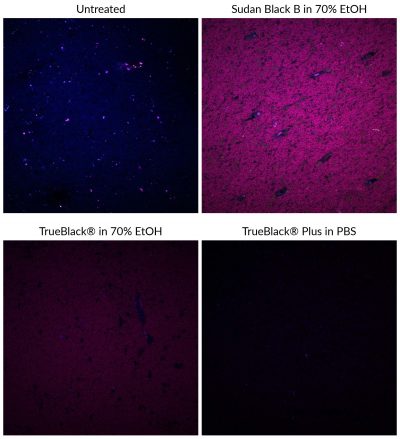 TrueBlack® Plus Lipofuscin Autofluorescence Quencher, 40X in DMSO - Image 2