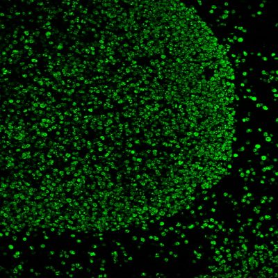 Tyramide Amplification Kit with HRP Goat Anti-Mouse and CF® Dye or Biotin Tyramide - Image 8