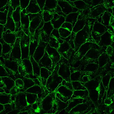 DNP Polyclonal Rabbit Antibody - Image 2