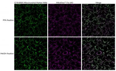 MitoView™ Fix 640 - Image 6