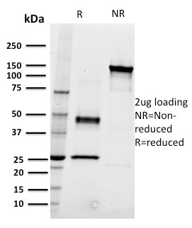 SDS-PAGE Analysis Purified CD22 Mouse Monoclonal Antibody (RFB4). Confirmation of Integrity and Purity of Antibody.