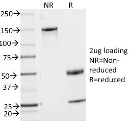 SDS-PAGE Analysis Purified CD2 Mouse Monoclonal Antibody (UMCD2). Confirmation of Integrity and Purity of Antibody.