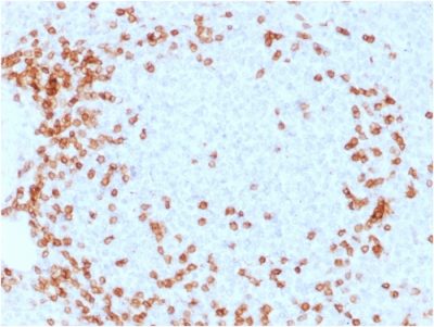 Formalin-fixed, paraffin-embedded human Spleen stained with CD3e Mouse Monoclonal Antibody (C3e/1931).
