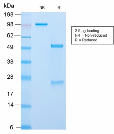 SDS-PAGE Analysis Purified ACTH Rabbit Recombinant Monoclonal Antibody (CLIP/2859R). Confirmation of Purity and Integrity of Antibody.