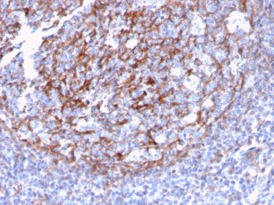 Formalin-fixed, paraffin-embedded human Tonsil Dendritic stained with CD21 / CR2 Recombinant Rabbit Monoclonal Antibody (CR2/3124R).