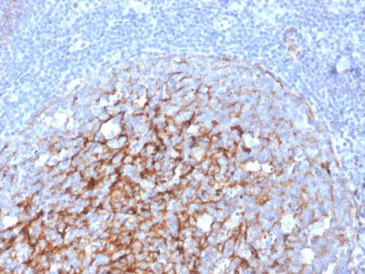 Formalin-fixed, paraffin-embedded human Tonsil stained with CD21-Monospecific Mouse Monoclonal Antibody (CR2/3247).