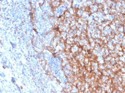 Formalin-fixed, paraffin-embedded human tonsil stained with CD11b Monospecific Mouse Monoclonal Antibody (ITGAM/3337).