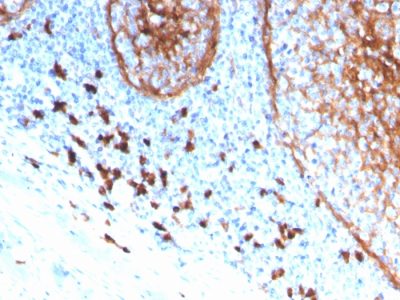 Formalin-fixed, paraffin-embedded human tonsil stained with CD11b Monospecific Mouse Monoclonal Antibody (ITGAM/3339).