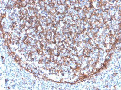 Formalin-fixed, paraffin-embedded human tonsil stained with CD11b Monospecific Mouse Monoclonal Antibody (ITGAM/3340).